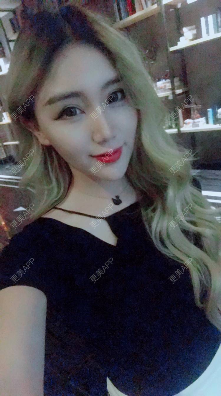 更美 - Bobbyya🌊的肋软骨隆鼻经验 | 肋软骨隆鼻 | 武汉