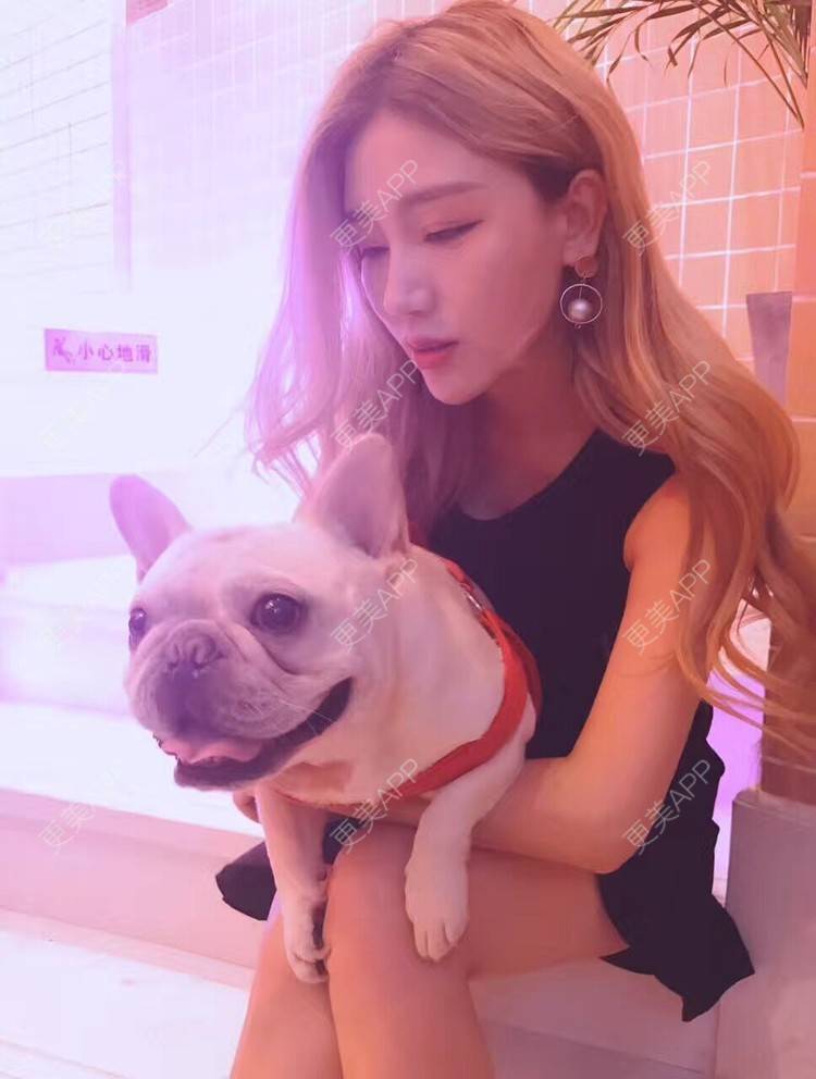 更美 - Bobbyya🌊的肋软骨隆鼻经验 | 肋软骨隆鼻 | 武汉