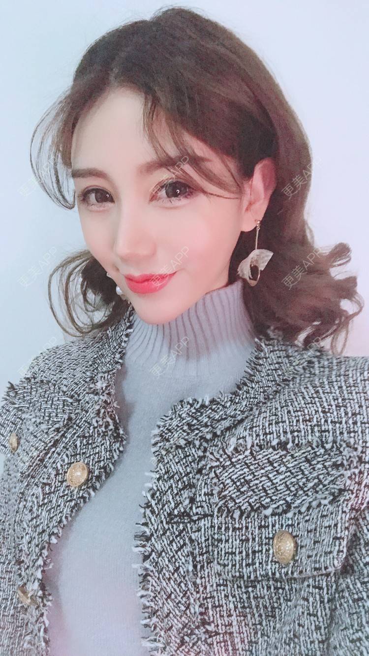 更美 - Bobbyya🌊的肋软骨隆鼻经验 | 肋软骨隆鼻 | 武汉