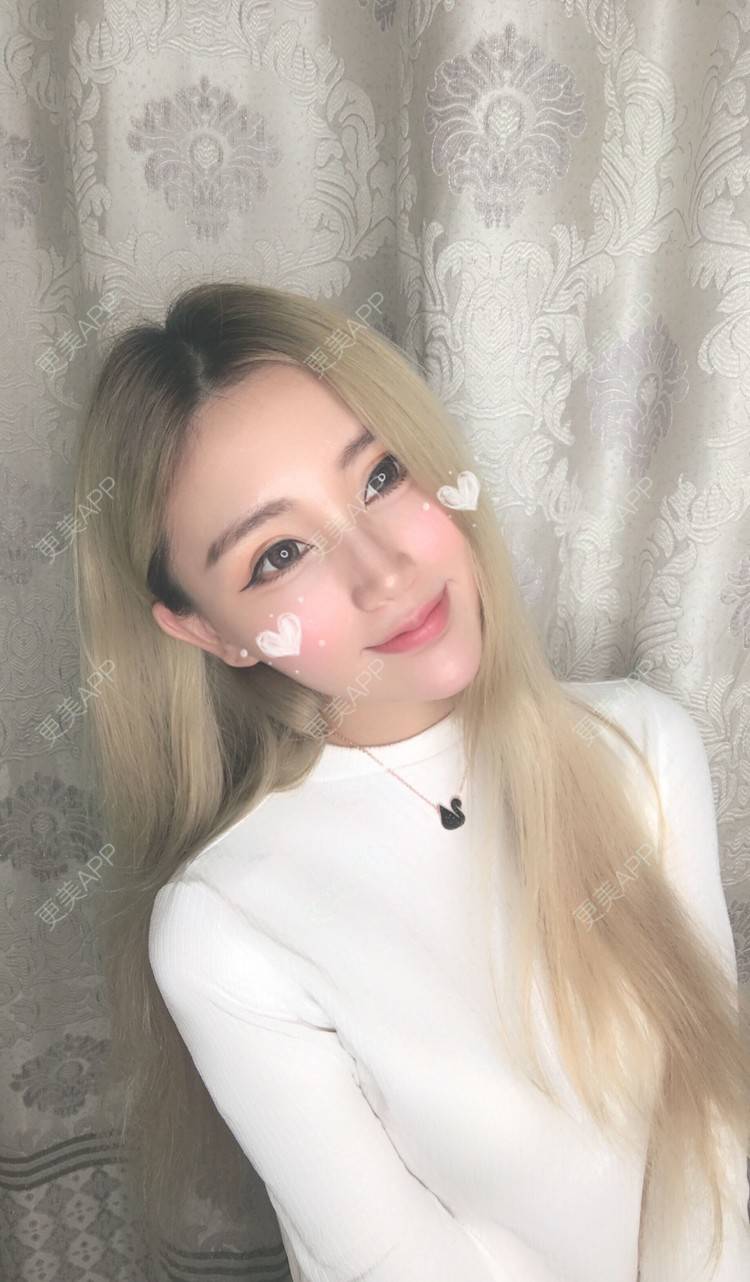 更美 - Bobbyya🌊的肋软骨隆鼻经验 | 肋软骨隆鼻 | 武汉