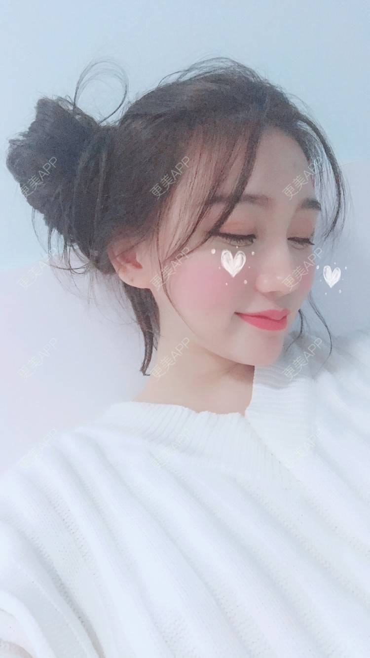 更美 - Bobbyya🌊的肋软骨隆鼻经验 | 肋软骨隆鼻 | 武汉