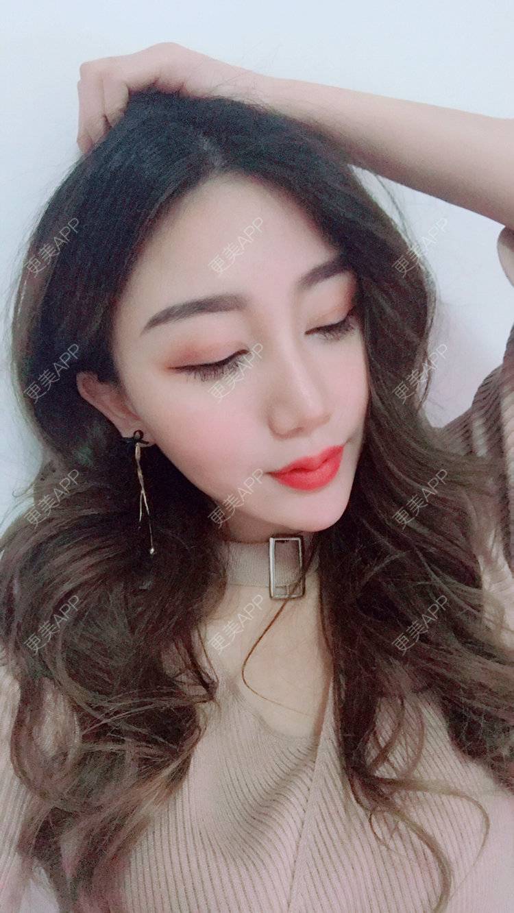 更美 - Bobbyya🌊的肋软骨隆鼻经验 | 肋软骨隆鼻 | 武汉