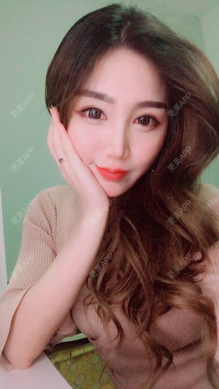 更美 - Bobbyya🌊的肋软骨隆鼻经验 | 肋软骨隆鼻 | 武汉