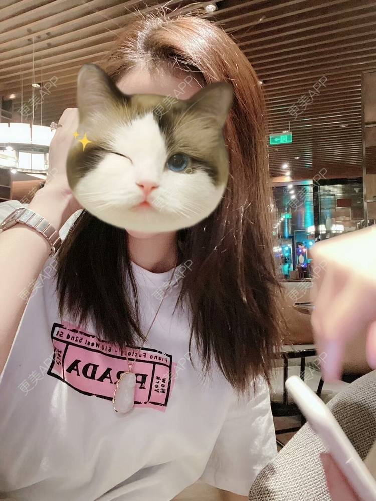 更美 - 冷葬花的激光紧缩阴道经验 | 上海 | 激光紧缩阴道