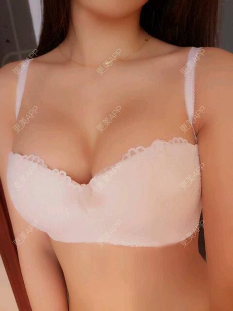 更美 - 更美用户2o60cQKUEs的假体隆胸经验 | 假体隆胸 | 乳头再造 | 美胸套餐 | 重庆