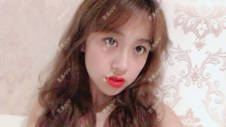 更美 - 更美用户KC03iU3j1t的玻尿酸苹果肌经验 | 玻尿酸苹果肌