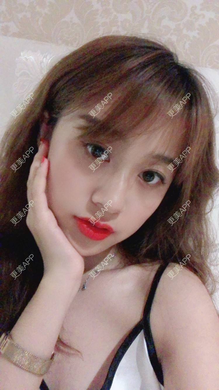 更美 - 更美用户KC03iU3j1t的玻尿酸苹果肌经验 | 玻尿酸苹果肌