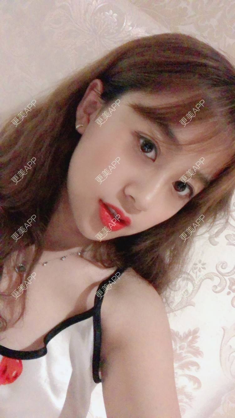 更美 - 更美用户KC03iU3j1t的玻尿酸苹果肌经验 | 玻尿酸苹果肌