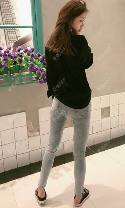 更美 - 更美用户GW64OOXNN4的吸脂瘦大腿经验 | 佛山 | 吸脂瘦大腿