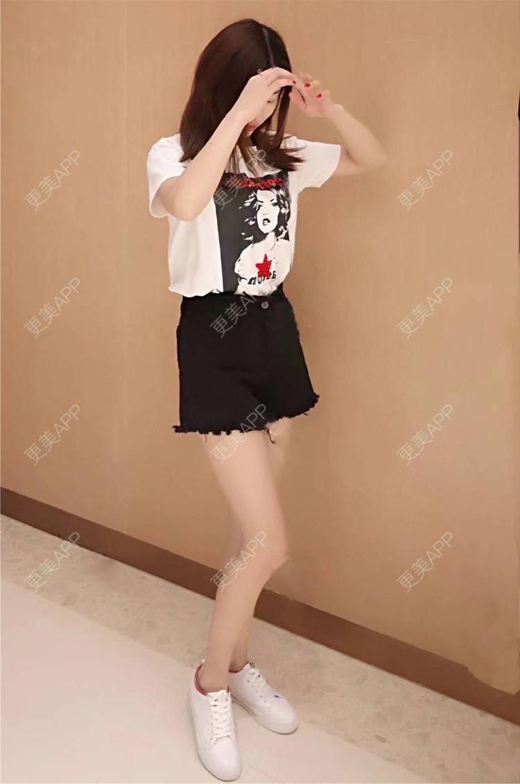 更美 - 更美用户GW64OOXNN4的吸脂瘦大腿经验 | 佛山 | 吸脂瘦大腿