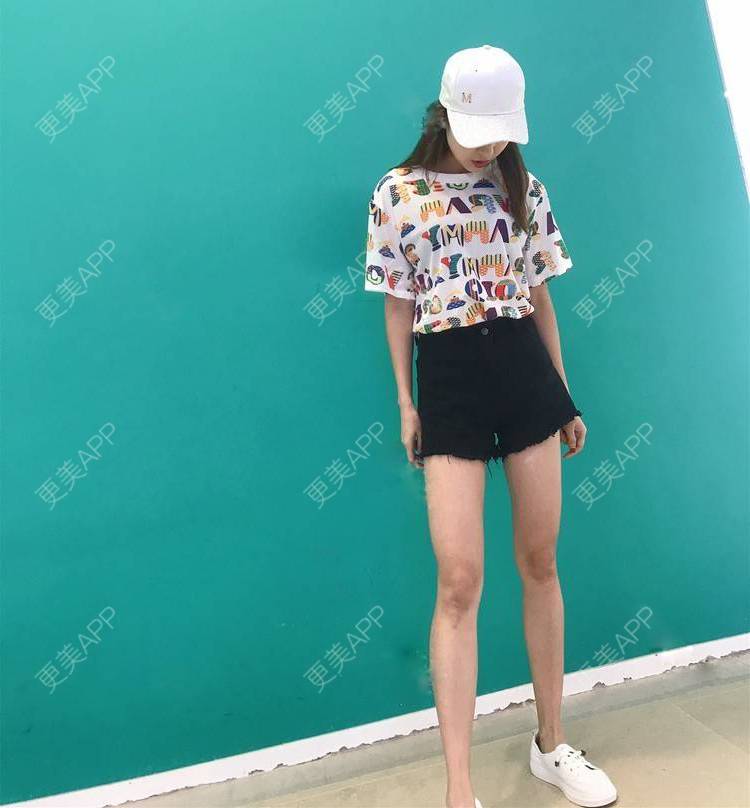 更美 - 更美用户GW64OOXNN4的吸脂瘦大腿经验 | 佛山 | 吸脂瘦大腿