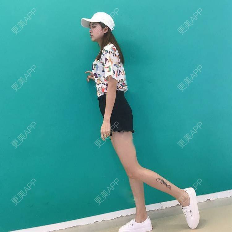 更美 - 更美用户GW64OOXNN4的吸脂瘦大腿经验 | 佛山 | 吸脂瘦大腿