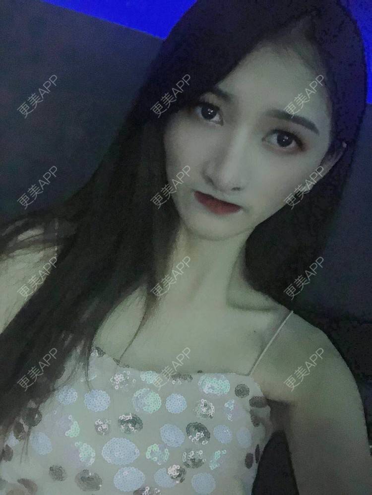 更美 - 最美的期待i的鼻形态修复经验 | 广州 | 鼻形态修复