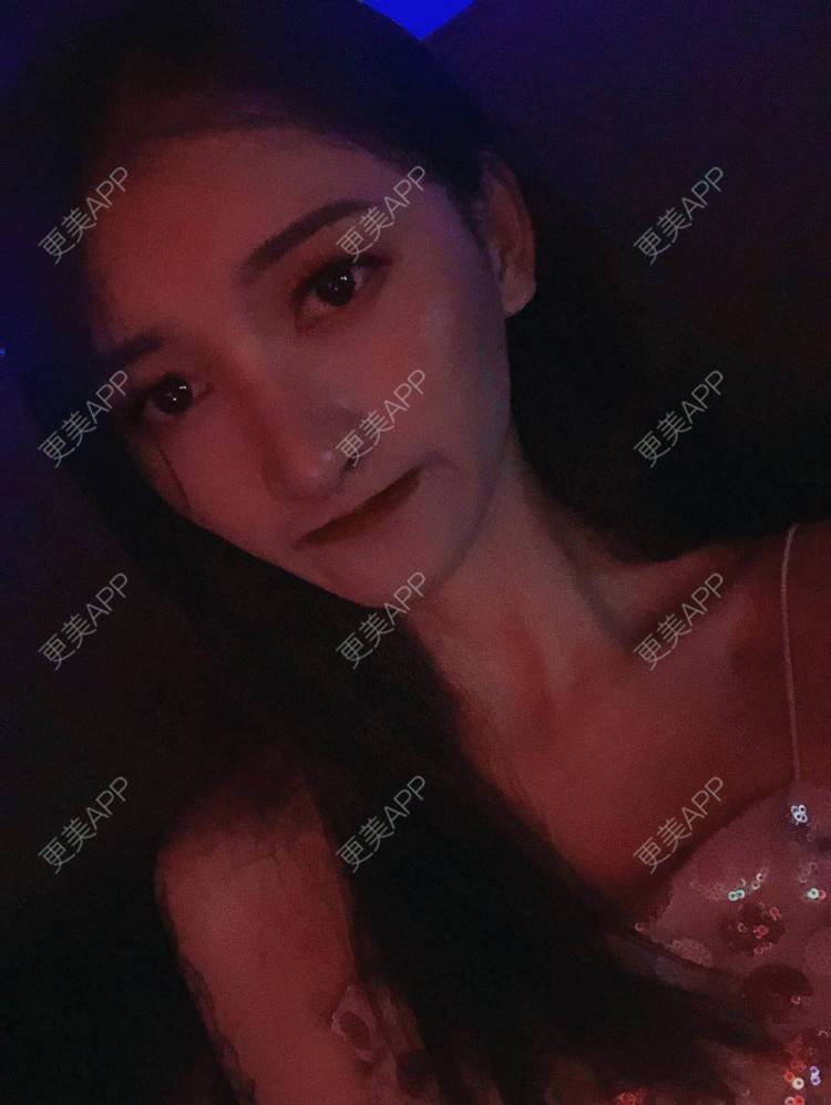 更美 - 最美的期待i的鼻形态修复经验 | 广州 | 鼻形态修复