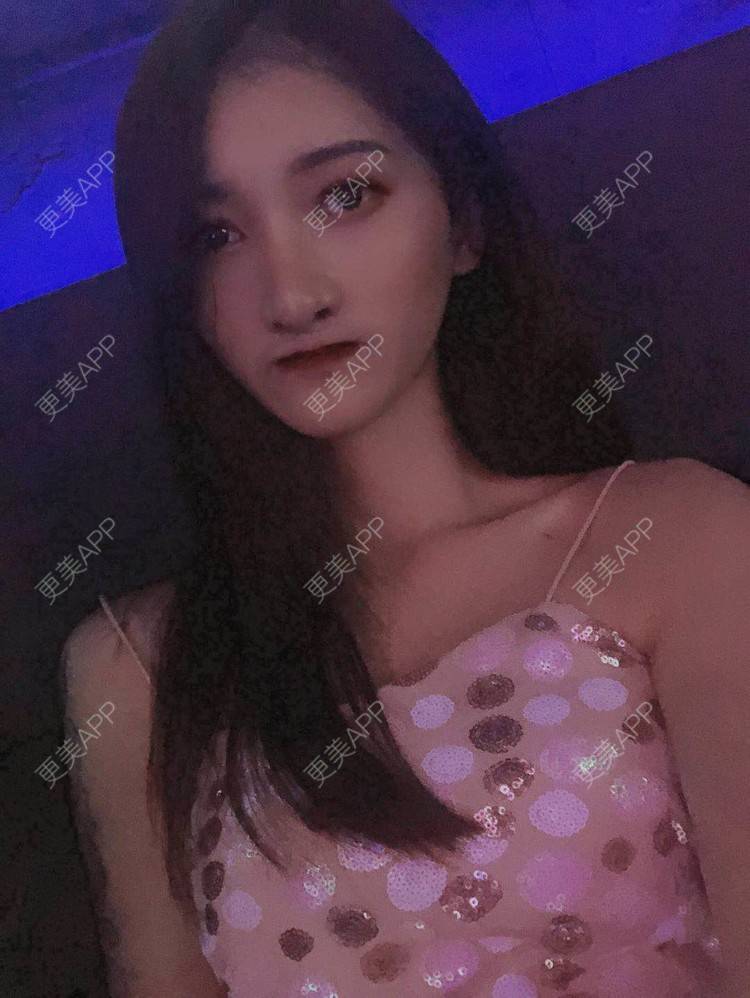 更美 - 最美的期待i的鼻形态修复经验 | 广州 | 鼻形态修复