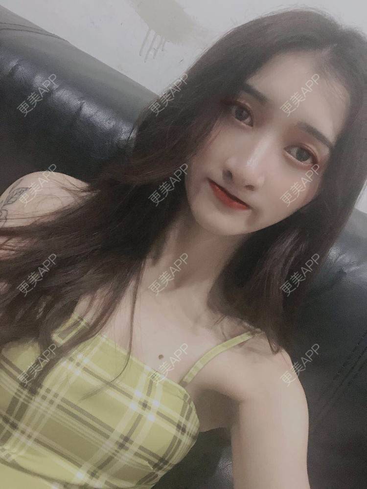 更美 - 最美的期待i的鼻形态修复经验 | 广州 | 鼻形态修复