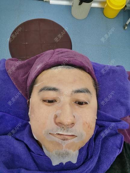 更美 - 更美用户OHIH5h9wWG的水光项目经验 | 郑州 | 水光项目