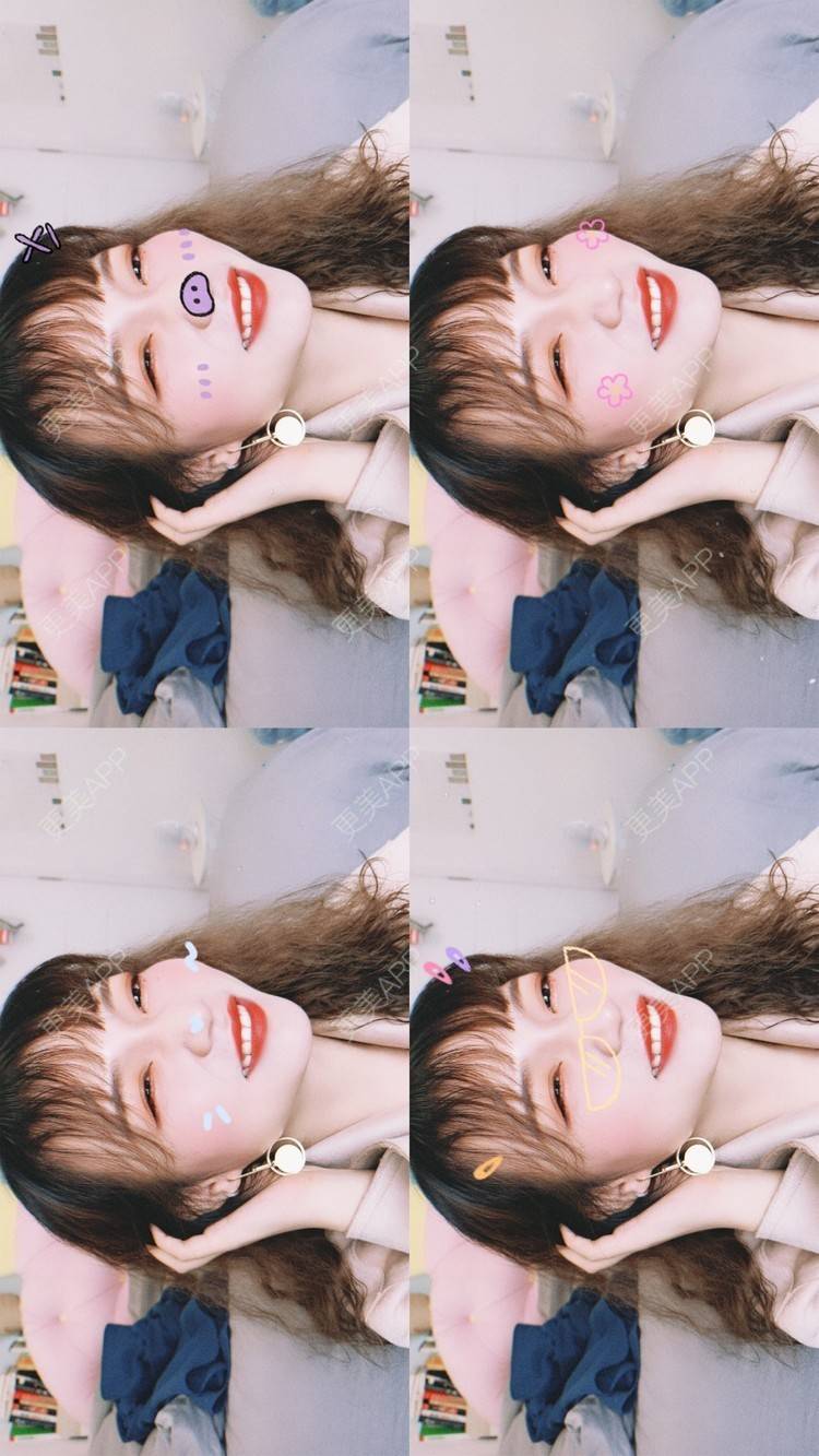 更美 - 我的发际线最美的激光脱发际线经验 | 激光脱发际线 | 上海