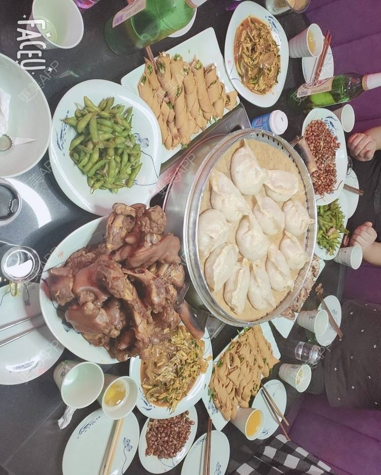 更美 - 我的发际线最美的激光脱发际线经验 | 激光脱发际线 | 上海