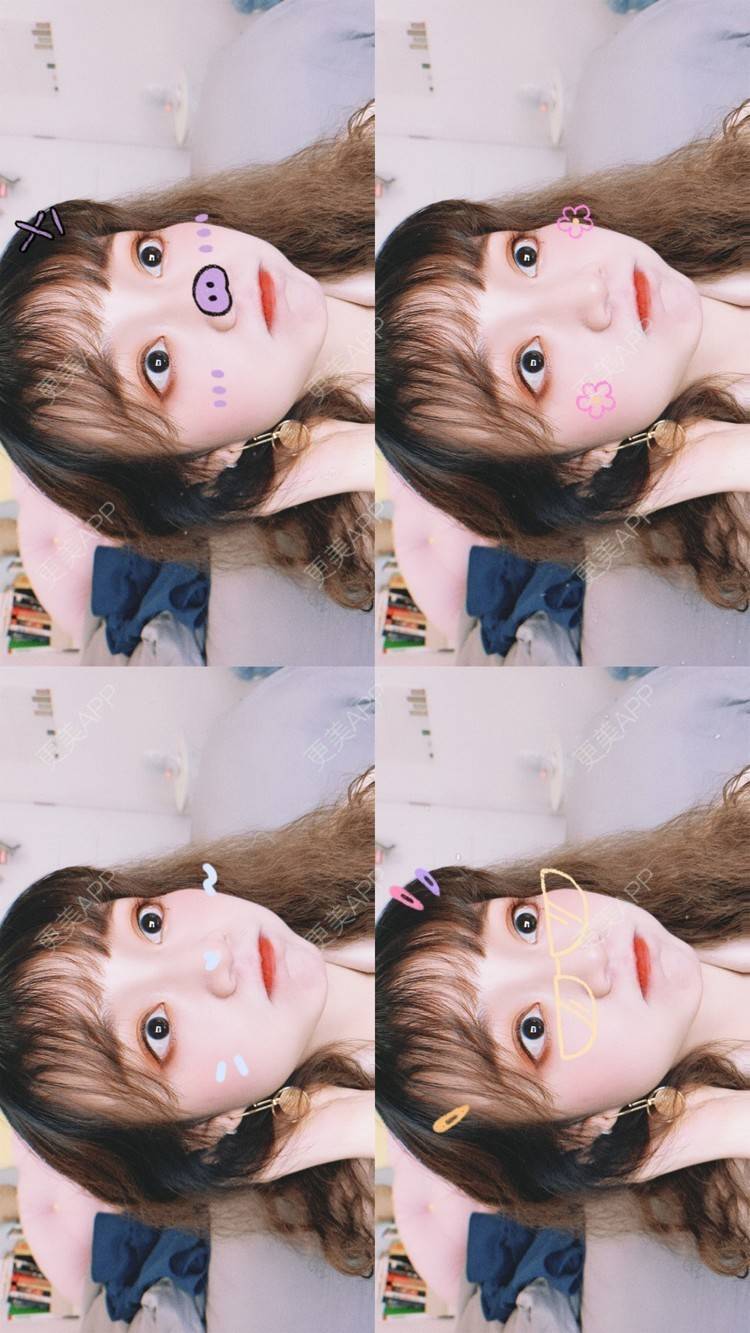 更美 - 我的发际线最美的激光脱发际线经验 | 激光脱发际线 | 上海