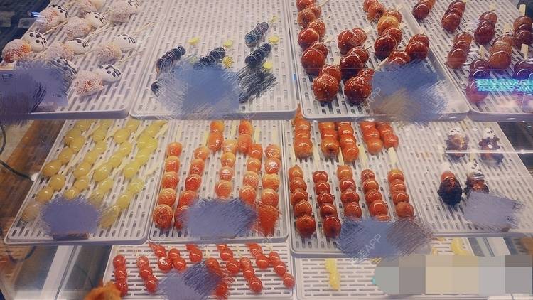 更美 - 我的发际线最美的激光脱发际线经验 | 激光脱发际线 | 上海