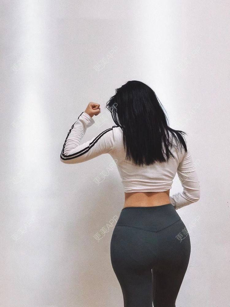 陈大事chiming的假体丰臀日记