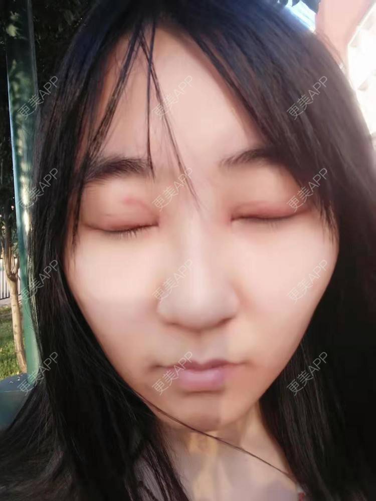 更美 - 你的女朋友的眼部多项经验 | 眼部多项 | 铜川