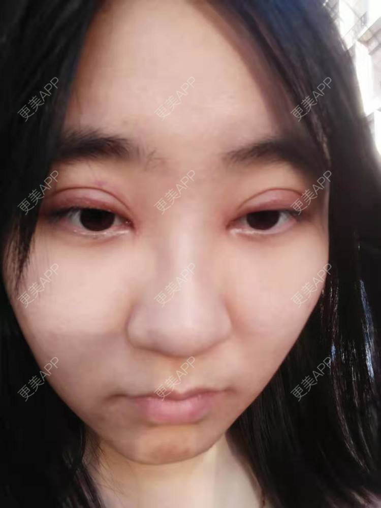 更美 - 你的女朋友的眼部多项经验 | 眼部多项 | 铜川