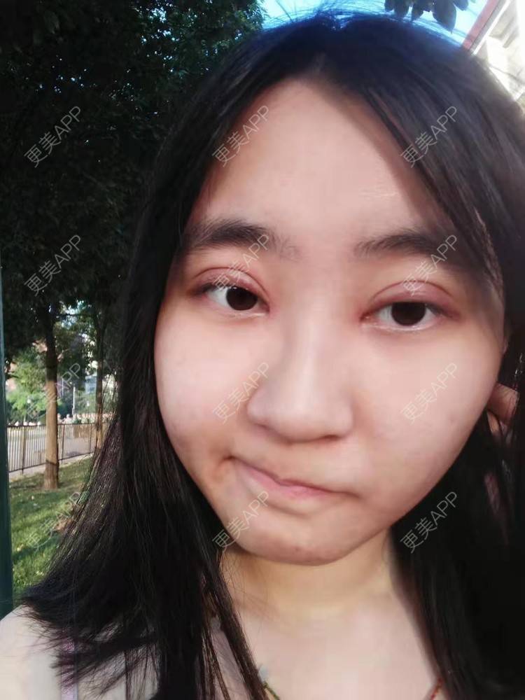 更美 - 你的女朋友的眼部多项经验 | 眼部多项 | 铜川