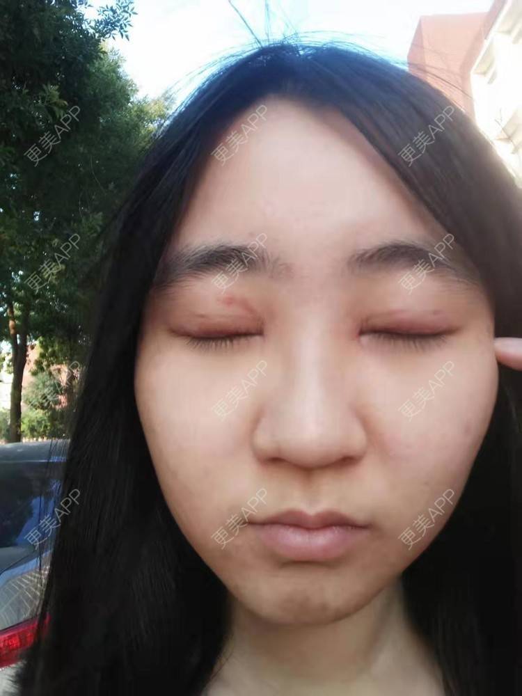 更美 - 你的女朋友的眼部多项经验 | 眼部多项 | 铜川