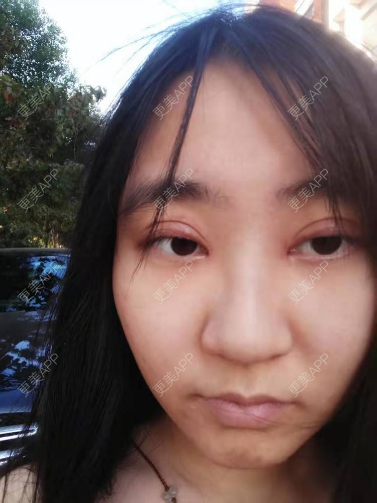 更美 - 你的女朋友的眼部多项经验 | 眼部多项 | 铜川