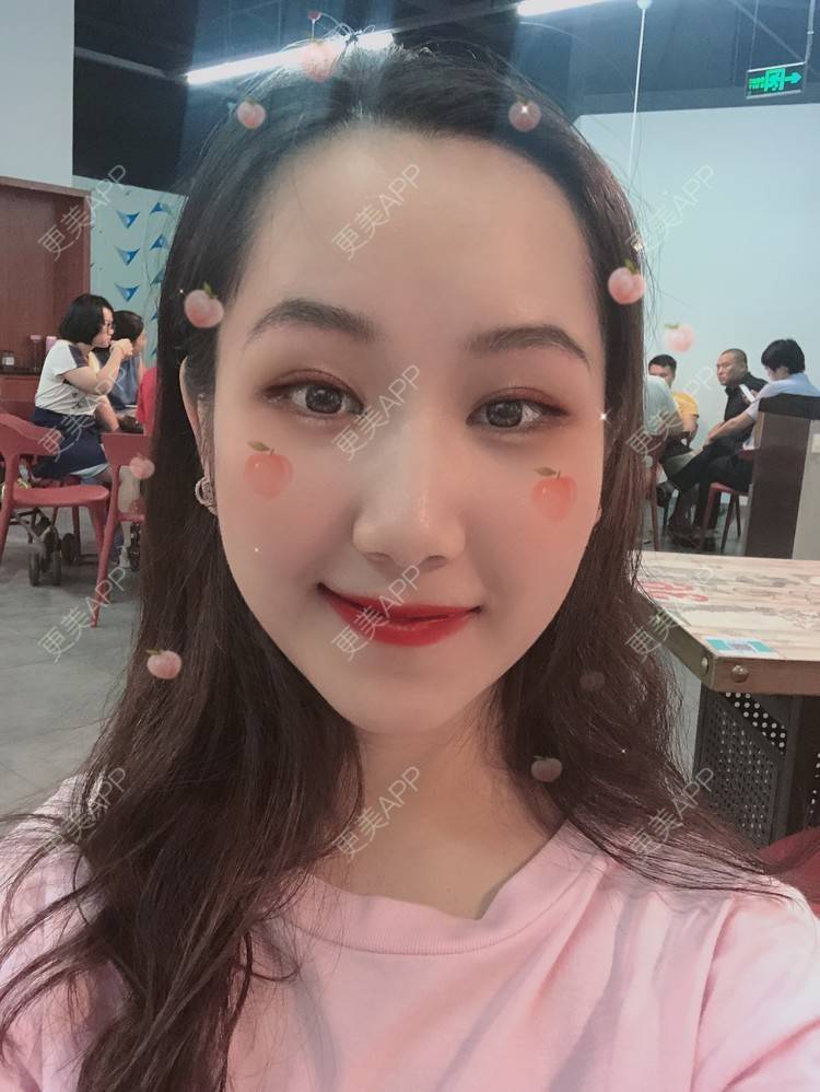 更美 - 小啊duang的切眉经验 | 切眉 | 临汾