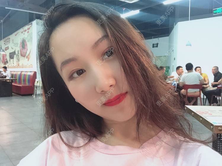 更美 - 小啊duang的切眉经验 | 切眉 | 临汾