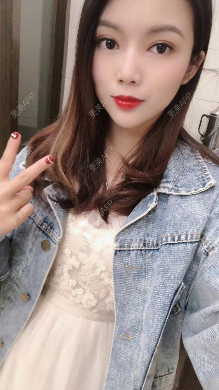 更美 - 更美用户T3PhxaY9Vo的玻尿酸下巴经验 | 广州 | 视频日记 | 玻尿酸下巴