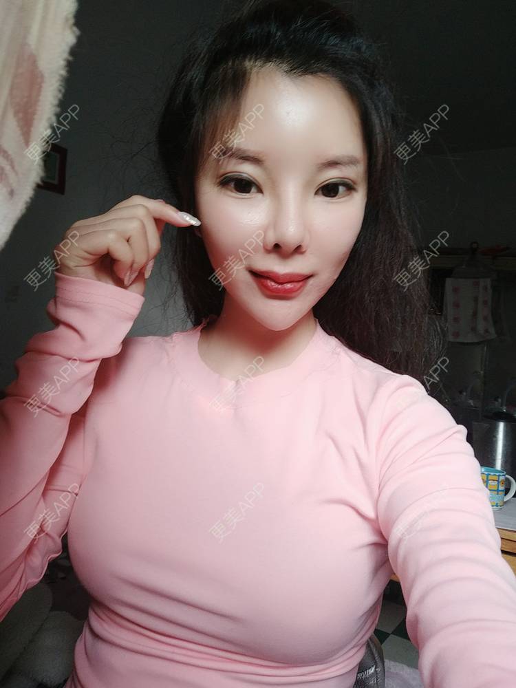 玻尿酸隆胸 | 美胸套餐 | 胸部下垂矫正 | 重庆 | 胶原蛋白丰胸