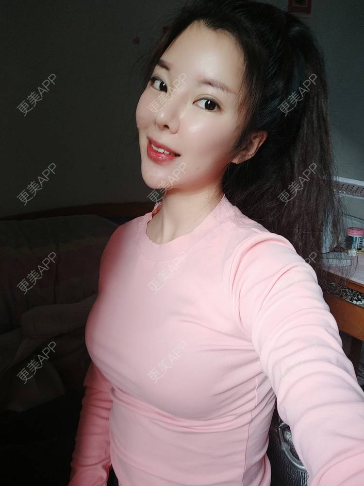 的假体隆胸日记 | 假体隆胸 | 自体脂肪隆胸 | 玻尿酸隆胸 | 美胸套餐