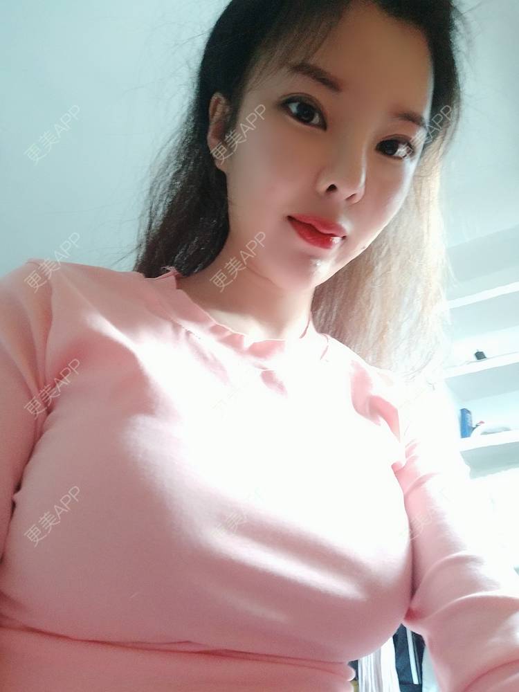 的假体隆胸日记 | 假体隆胸 | 自体脂肪隆胸 | 玻尿酸隆胸 | 美胸套餐