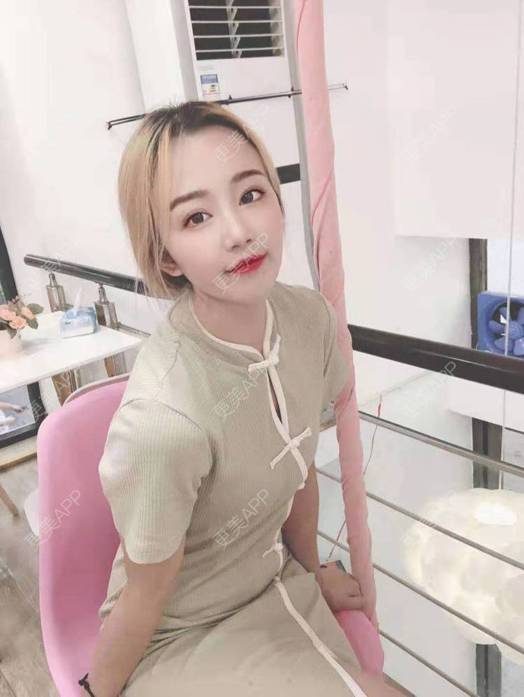 更美 - 更美用户cZDofR1cWa的双眼皮修复经验 | 成都 | 双眼皮修复