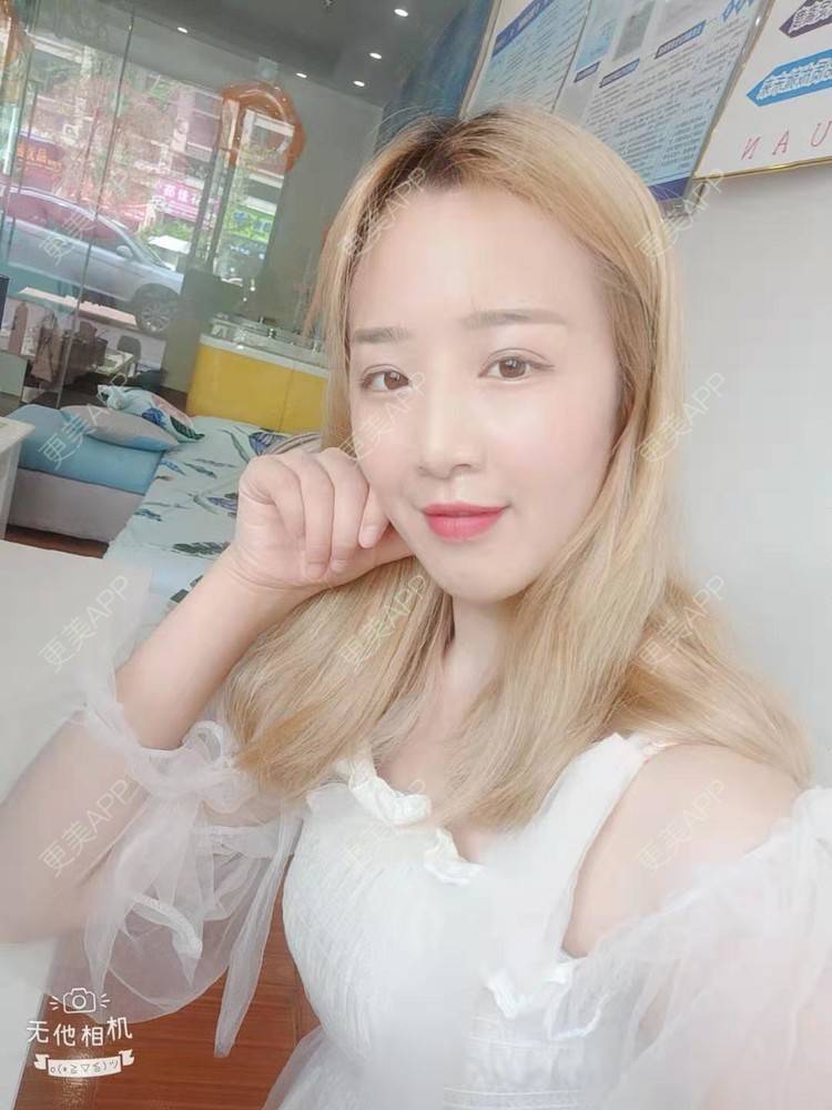 更美 - 更美用户cZDofR1cWa的双眼皮修复经验 | 成都 | 双眼皮修复