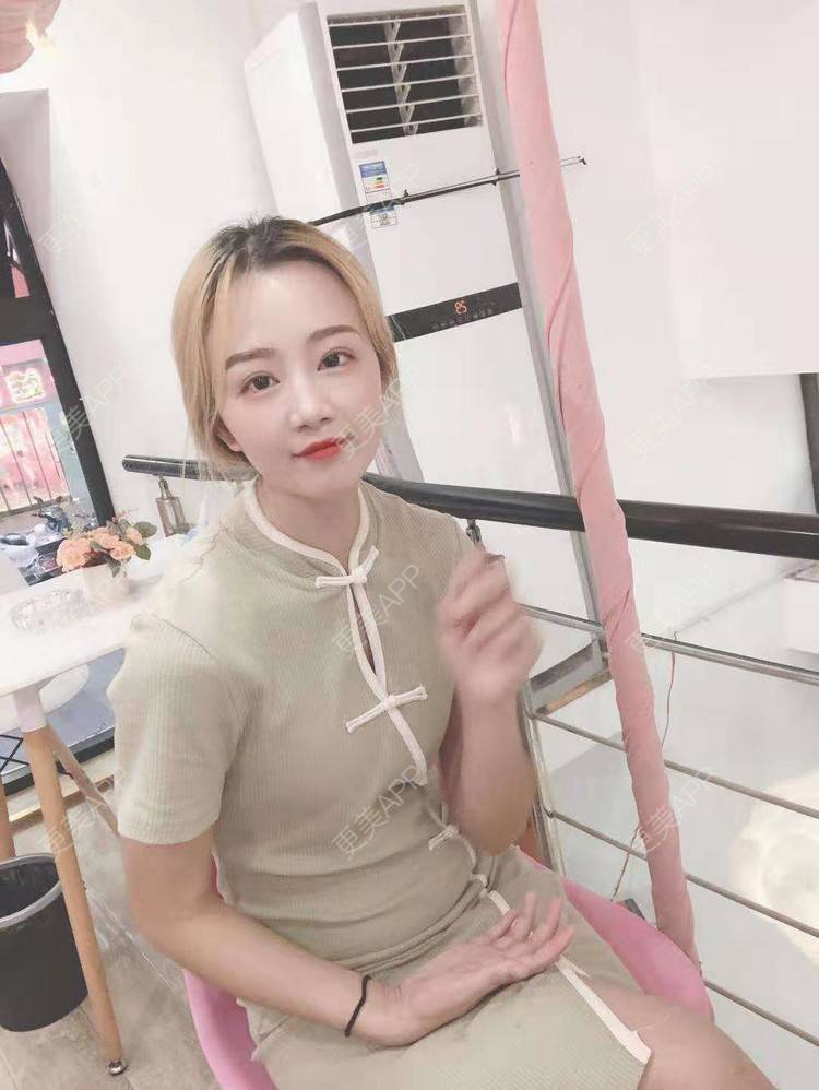 更美 - 更美用户cZDofR1cWa的双眼皮修复经验 | 成都 | 双眼皮修复