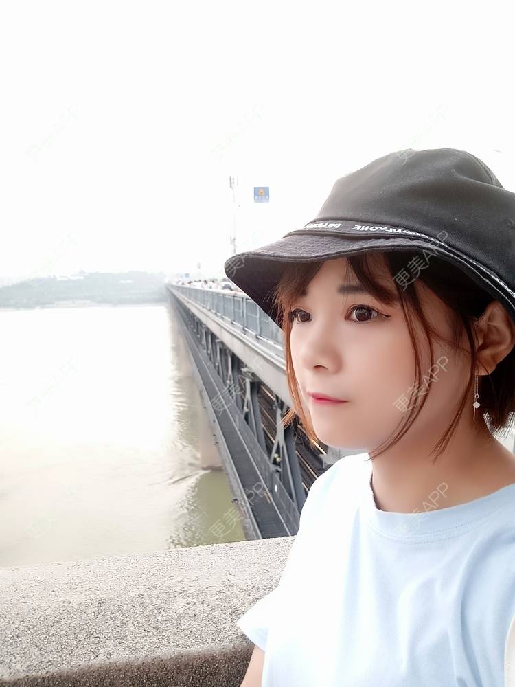 更美 - 更美用户2xAqCgwVY0的内切去眼袋经验 | 内切去眼袋 | 武汉
