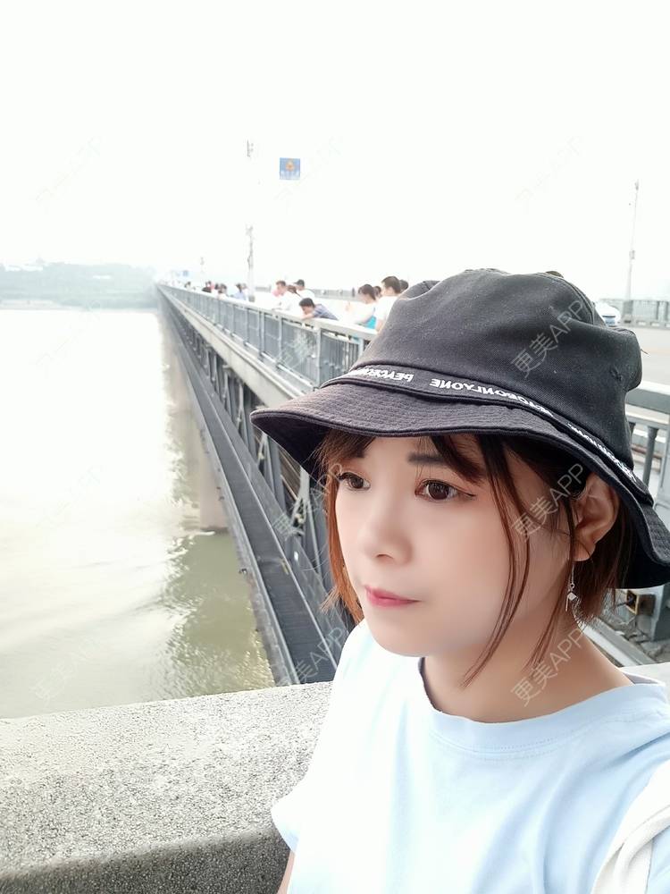 更美 - 更美用户2xAqCgwVY0的内切去眼袋经验 | 内切去眼袋 | 武汉