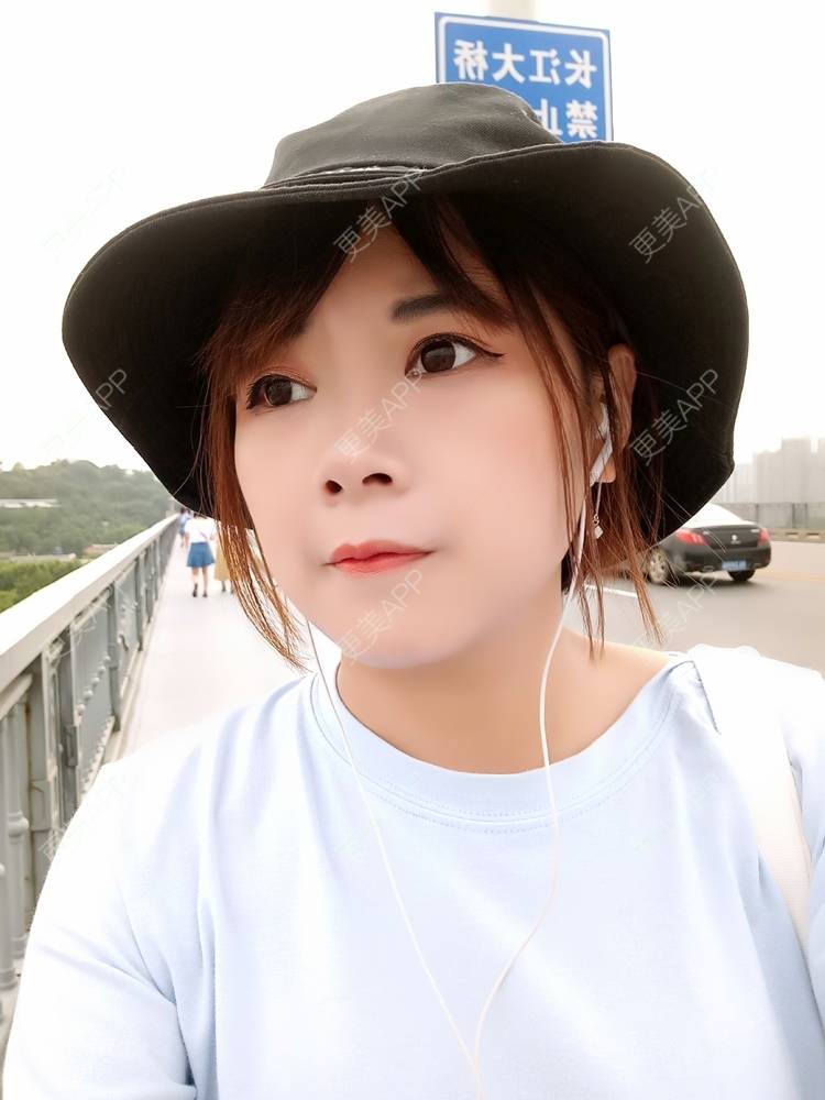 更美 - 更美用户2xAqCgwVY0的内切去眼袋经验 | 内切去眼袋 | 武汉