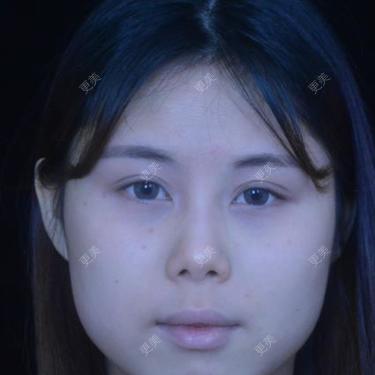 瘋子范ル内