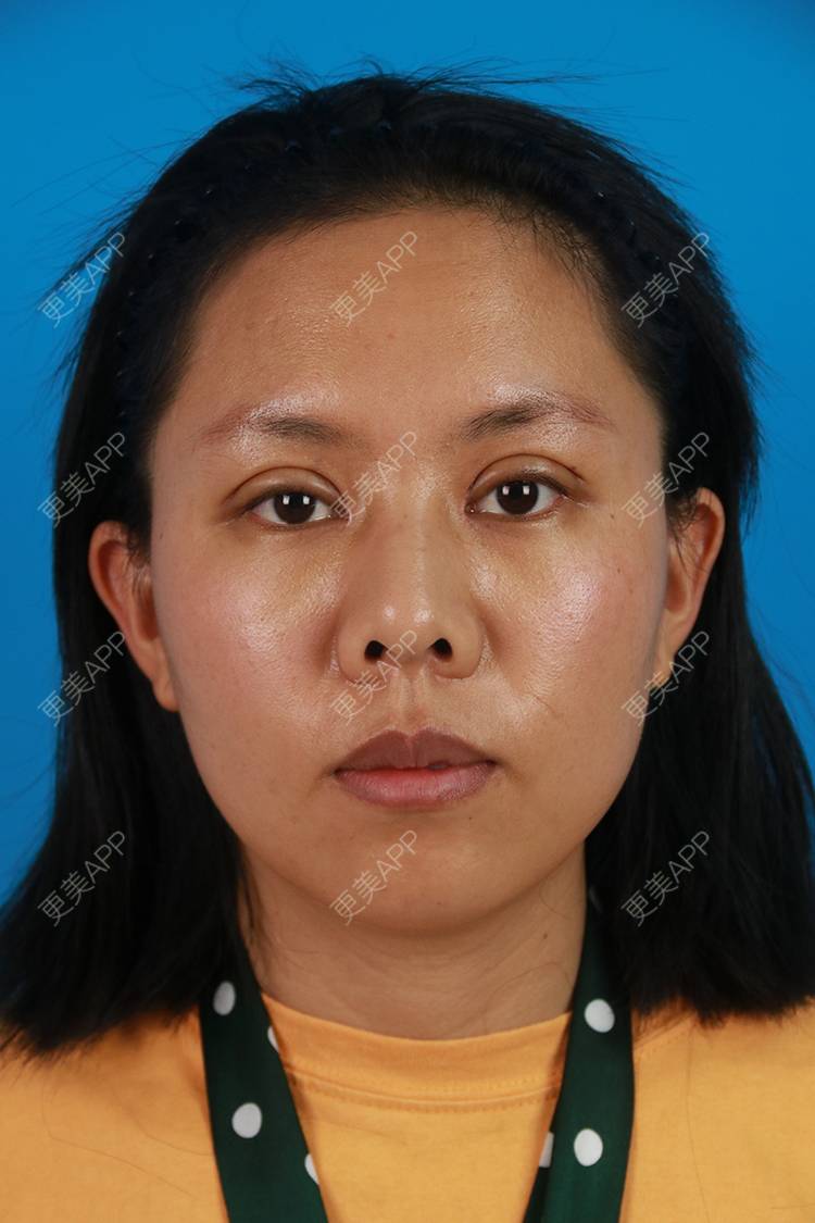 雨晨的清风的双眼皮日记