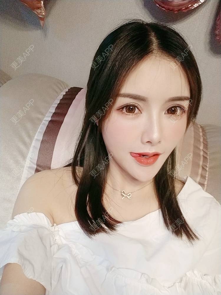 更美 - Daisy11的自体脂肪全面部填充经验 | 自体脂肪全面部填充 | 视频日记 | 重庆