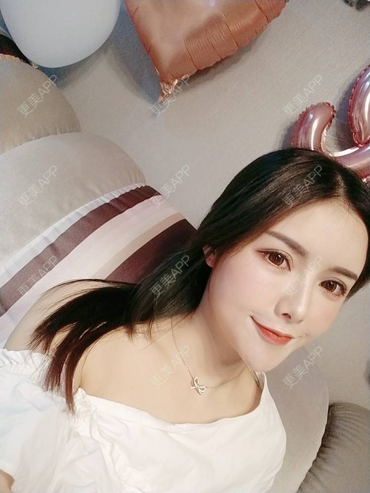 更美 - Daisy11的自体脂肪全面部填充经验 | 自体脂肪全面部填充 | 视频日记 | 重庆