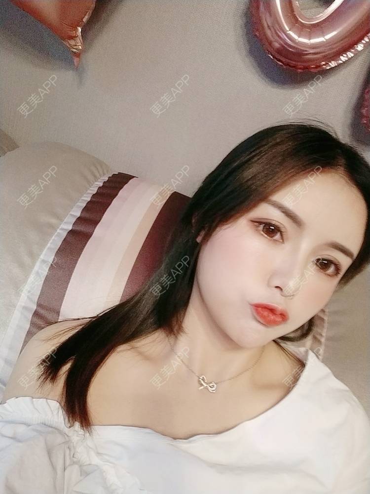 更美 - Daisy11的自体脂肪全面部填充经验 | 自体脂肪全面部填充 | 视频日记 | 重庆
