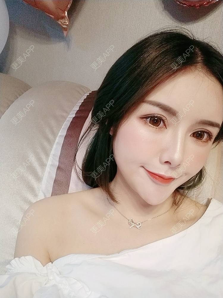 更美 - Daisy11的自体脂肪全面部填充经验 | 自体脂肪全面部填充 | 视频日记 | 重庆