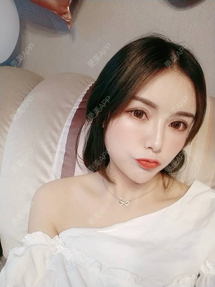 更美 - Daisy11的自体脂肪全面部填充经验 | 自体脂肪全面部填充 | 视频日记 | 重庆